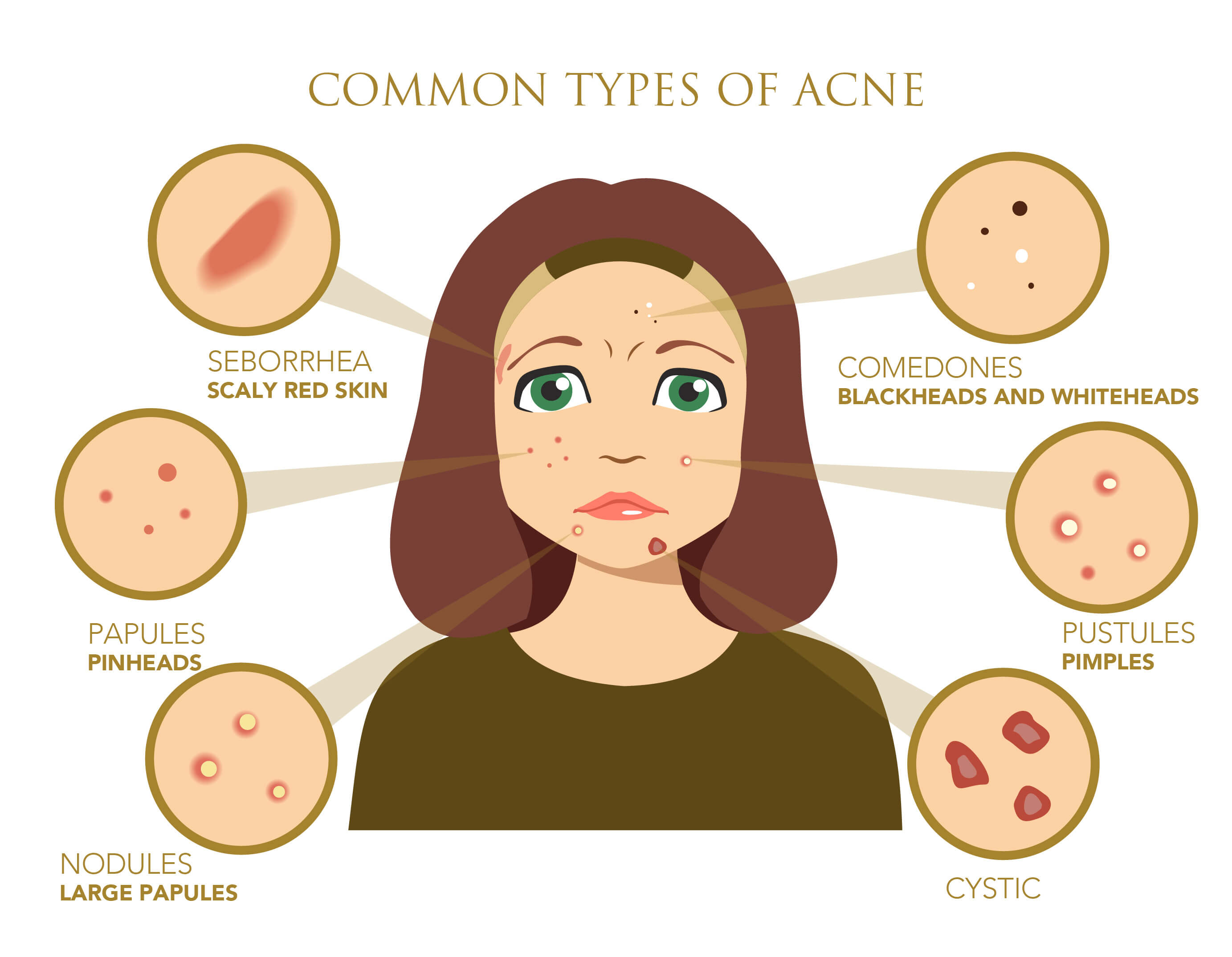 Types Of Spots On Face